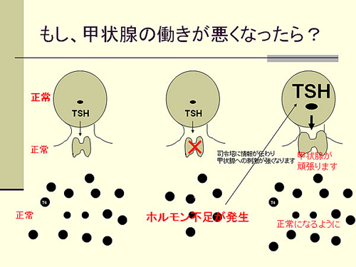 もし甲状腺の働きがわるくなったら？