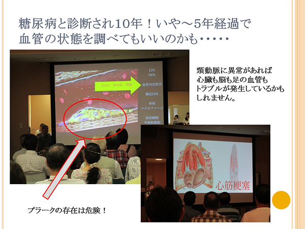 糖尿病と診断され10年、いや5年経過で血管の状態をしらべてもいいのかも